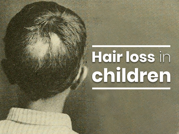 Hair Loss For Kids
 What Causes Hair Loss In Children Here s Everything You