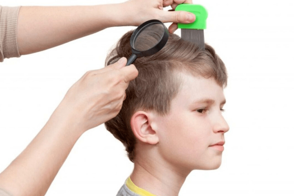 Hair Loss For Kids
 Hair Loss in Children esteGrande Hair Transplant Services