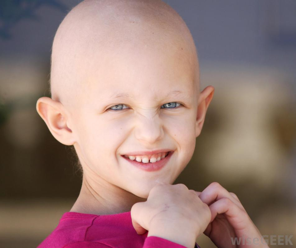 Hair Loss In Children
 What Causes Chemotherapy Hair Loss with pictures