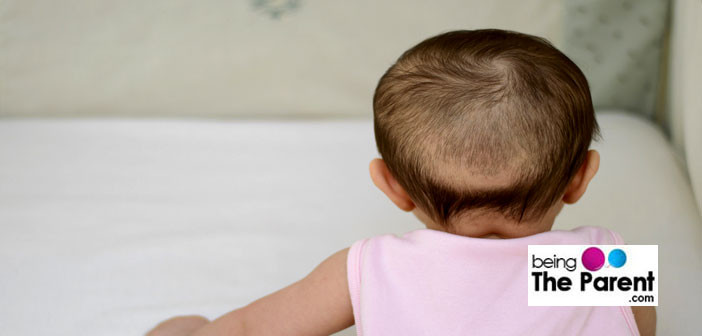 Hair Loss In Children
 Premature Balding In Children Causes And Treatments