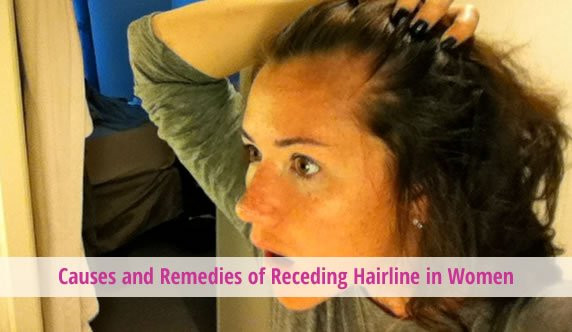 Hairstyles For Receding Hairline Female
 Causes and Reme s of Receding Hairline in Women