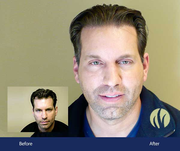 Mens Haircuts Minneapolis
 Before and After Men s Gallery