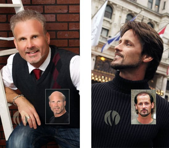 Mens Haircuts Minneapolis
 Men s Hair Replacement Minneapolis