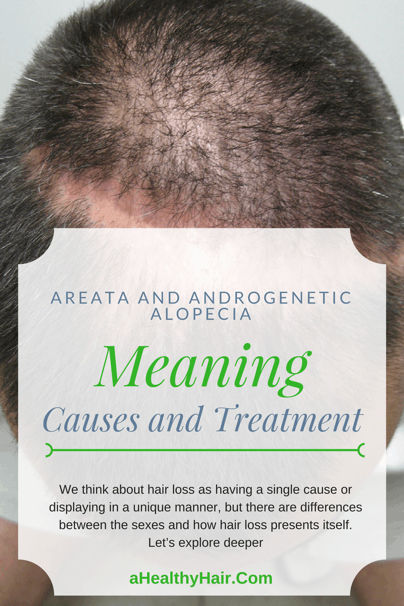 Sudden Hair Loss In Children
 Areata and Androgenetic Alopecia in Men and Women Meaning
