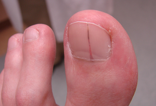 Toe Nail Colors Health
 Ideal Cure December 2014