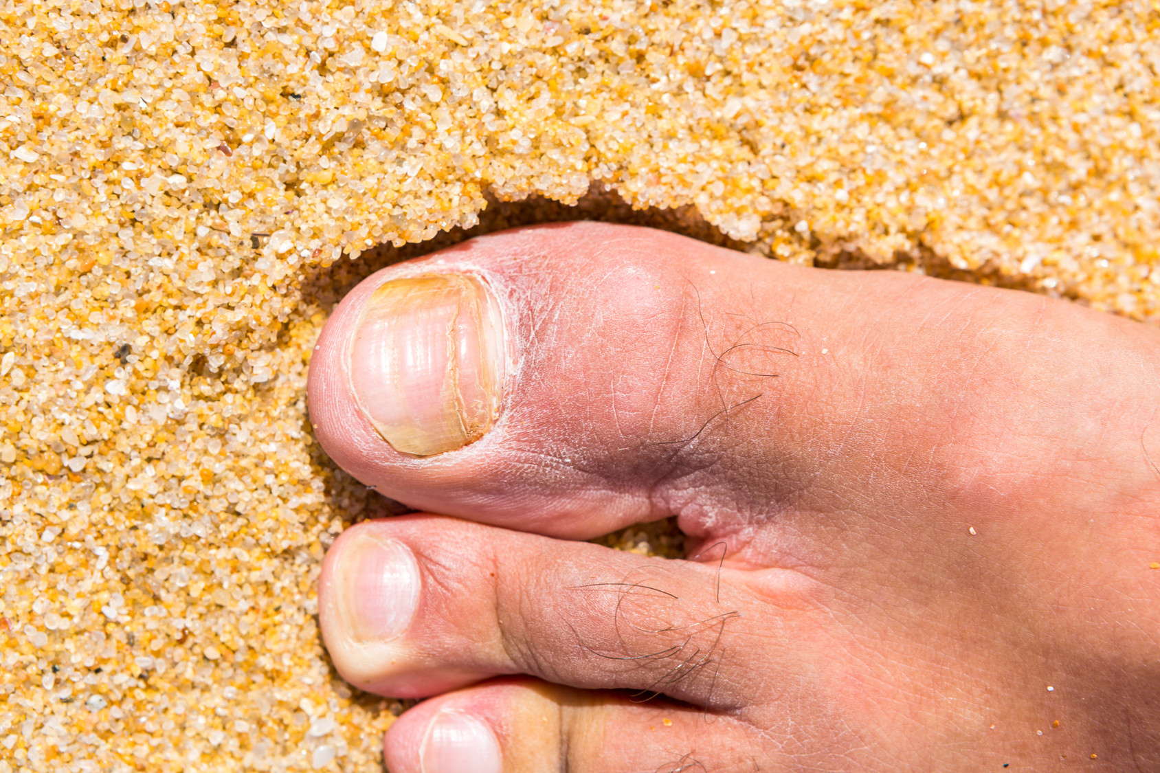 Toe Nail Colors Health
 9 Things Your Feet Are Trying To Tell You About Your Health