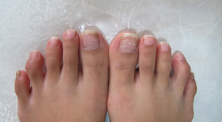 Toe Nail Colors Health
 What do your nails tell about your health