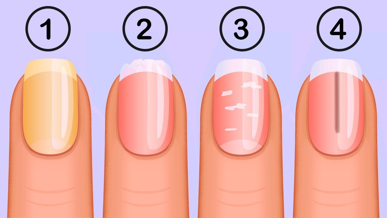 Toe Nail Colors Health
 5 Things Your Nails Can Tell You About Your Health