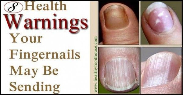 Toe Nail Colors Health
 The 25 best Fingernail health ideas on Pinterest