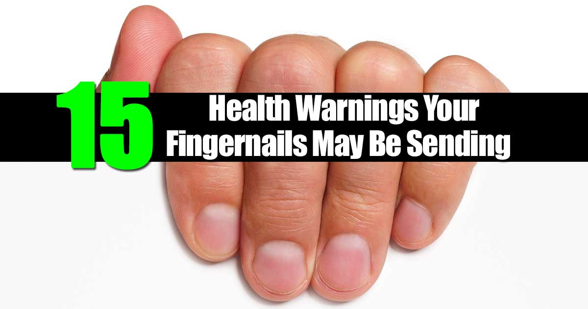 Toe Nail Colors Health
 15 Health Warnings Your Fingernails May Be Sending