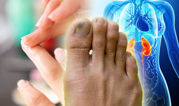 Toe Nail Colors Health
 Discoloured or YELLOW nails could be a symptom of a fungal